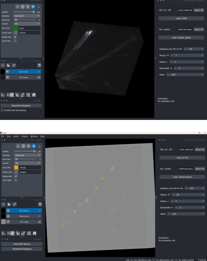 Comparaison entre les annotations de vérité terrain et le volume 3D : les structures visibles ne correspondent pas toujours aux points de référence.